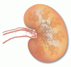 files_articles_888-Kidney[aaa63f88c59aa4a4b8b516474594ce9e].gif